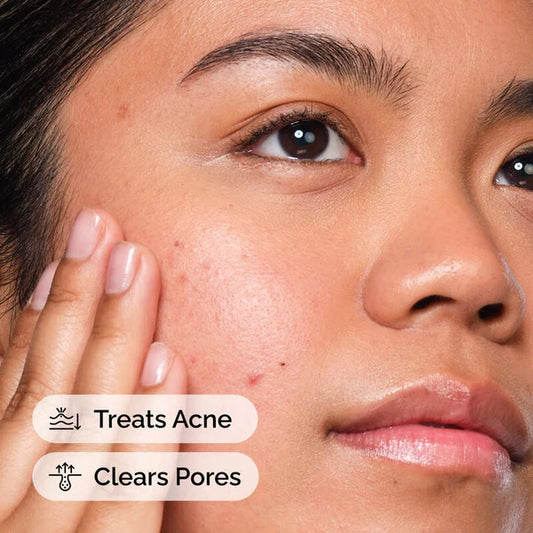 Salicylic Acid 2% Solution